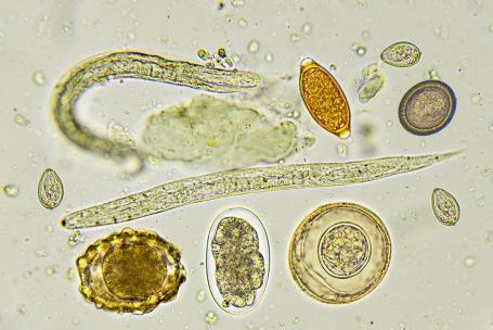 Worm Analysis
